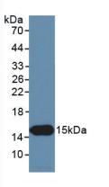 Inhibin Beta C (INHbC) Human Monoclonal Antibody