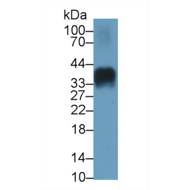 Insulin (INS) Human Monoclonal Antibody