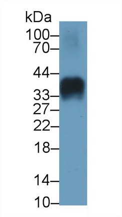 Insulin (INS) Human Monoclonal Antibody
