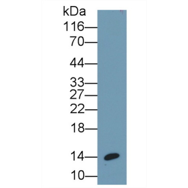 Insulin (INS) Human Monoclonal Antibody