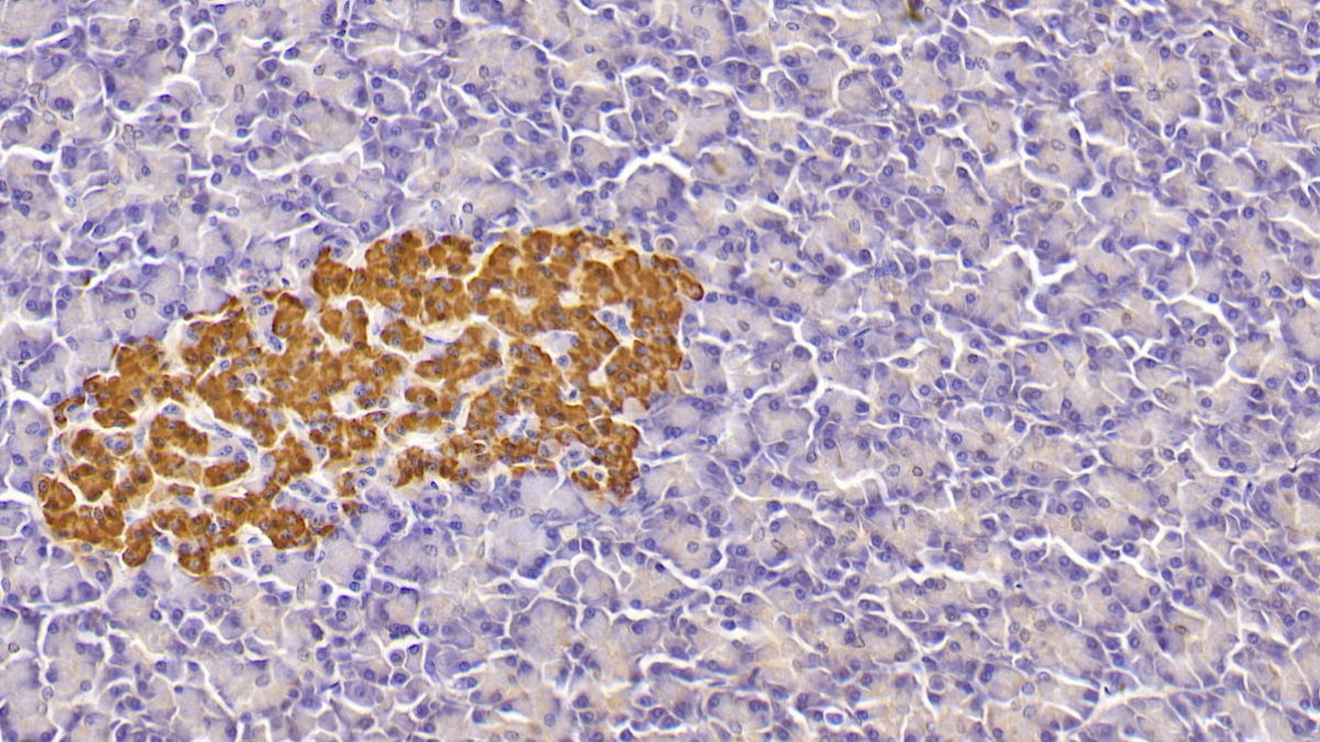 Insulin (INS) Human Monoclonal Antibody