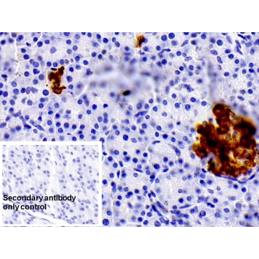Insulin (INS) Human Monoclonal Antibody