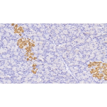 Insulin (INS) Human Monoclonal Antibody