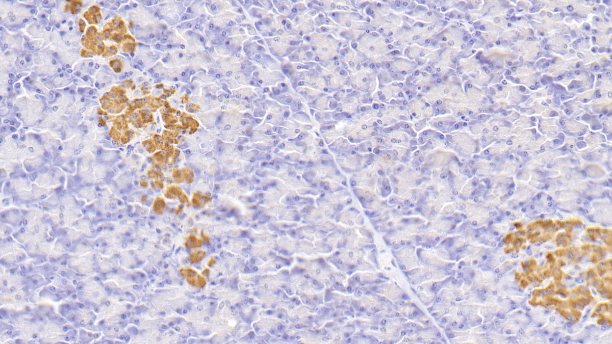 Insulin (INS) Human Monoclonal Antibody