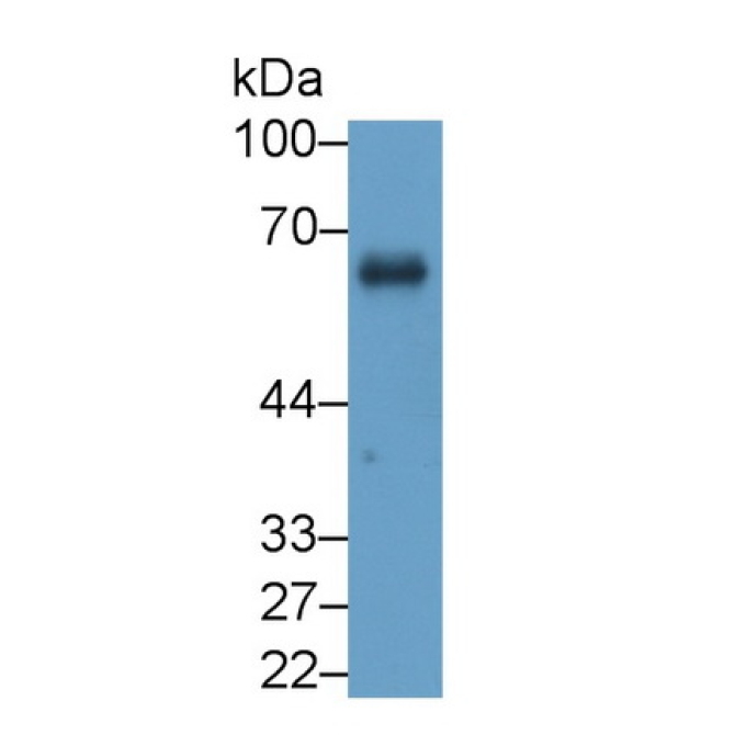 Cluster Of Differentiation 55 (CD55) Human Monoclonal Antibody