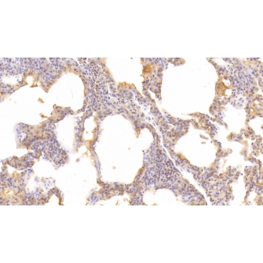 Cluster Of Differentiation 55 (CD55) Human Monoclonal Antibody