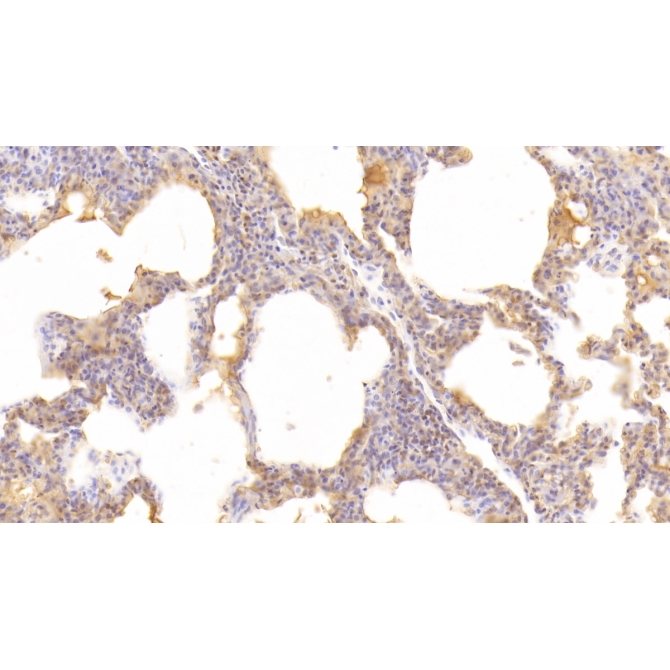 Cluster Of Differentiation 55 (CD55) Human Monoclonal Antibody