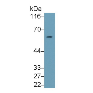 Cluster Of Differentiation 55 (CD55) Human Monoclonal Antibody