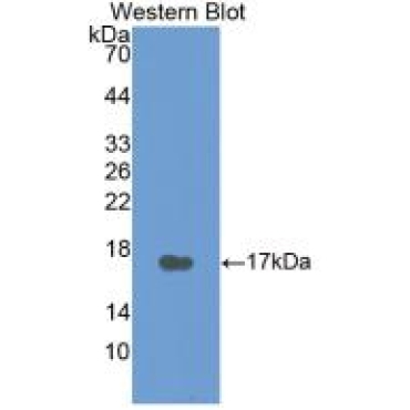 Calcitonin (CT) Human Monoclonal Antibody