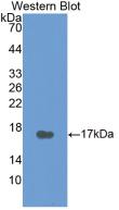 Calcitonin (CT) Human Monoclonal Antibody