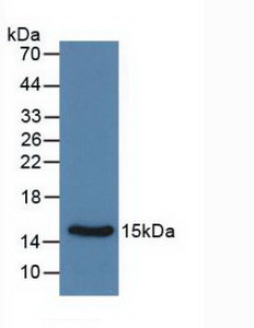 Calcitonin (CT) Rat Monoclonal Antibody