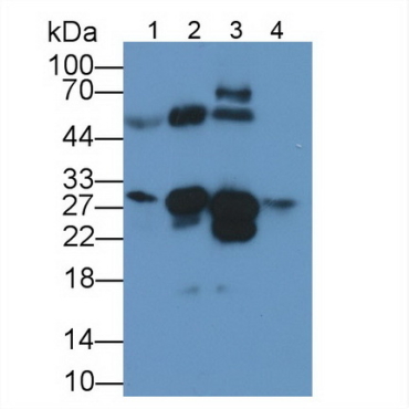 Cardiac Troponin I (cTnI) Human Monoclonal Antibody