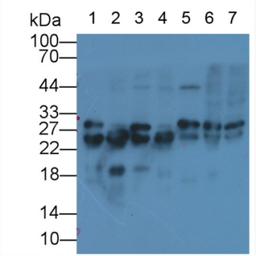 Cardiac Troponin I (cTnI) Human Monoclonal Antibody