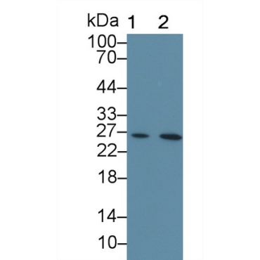 Cardiac Troponin I (cTnI) Human Monoclonal Antibody