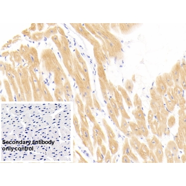 Cardiac Troponin I (cTnI) Human Monoclonal Antibody