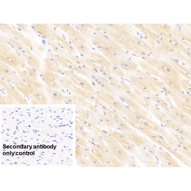 Cardiac Troponin I (cTnI) Human Monoclonal Antibody