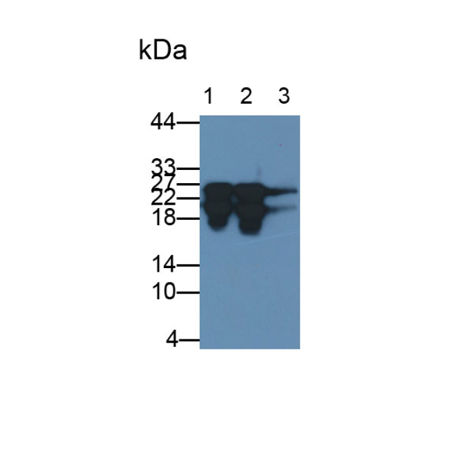 Cardiac Troponin I (cTnI) Human Monoclonal Antibody