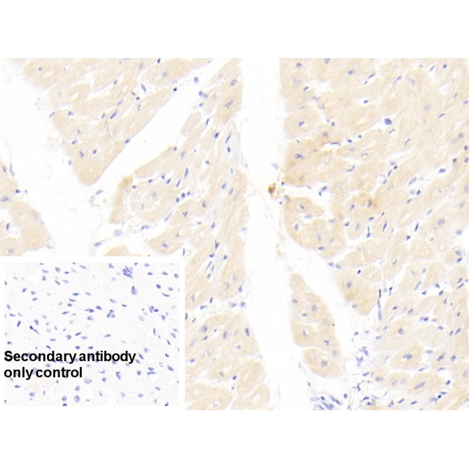 Cardiac Troponin I (cTnI) Human Monoclonal Antibody