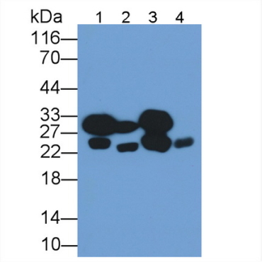 Cardiac Troponin I (cTnI) Human Monoclonal Antibody