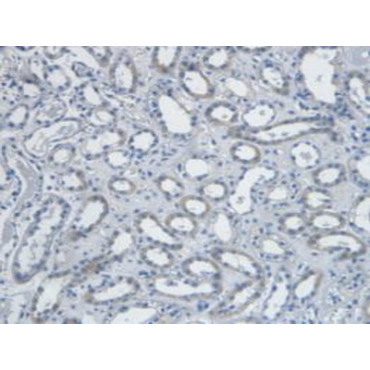 Endothelin 1 (EDN1) Human Monoclonal Antibody