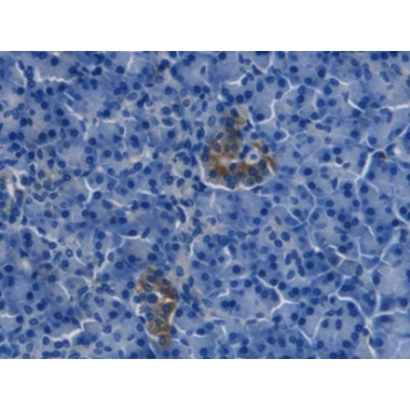 Endothelin 1 (EDN1) Human Monoclonal Antibody