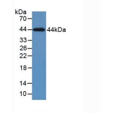 Cytokeratin 5 (CK5) Human Monoclonal Antibody