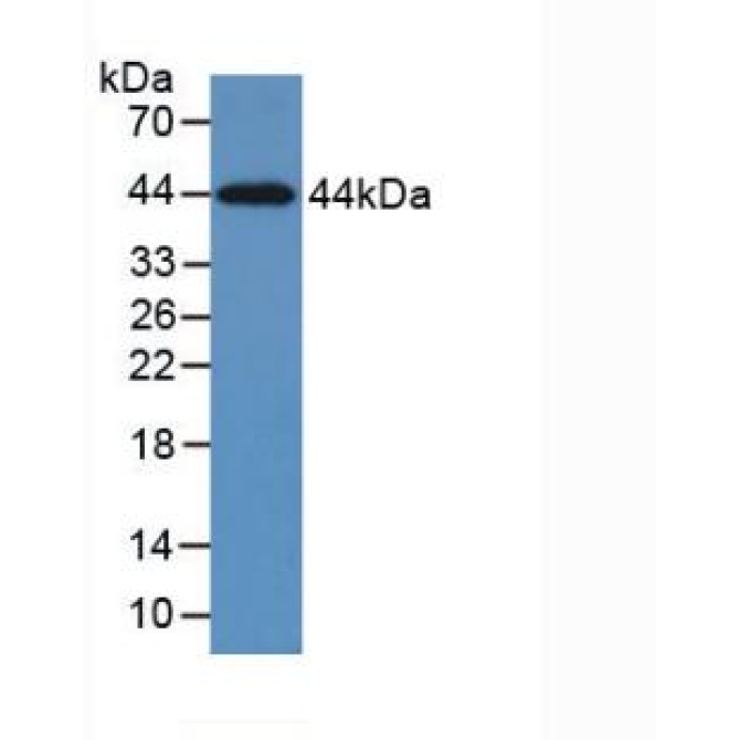 Cytokeratin 5 (CK5) Human Monoclonal Antibody