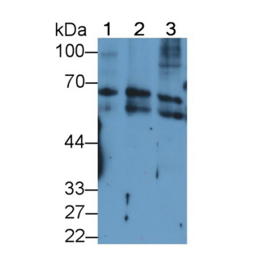 Keratin 2 (CK2) Human Monoclonal Antibody