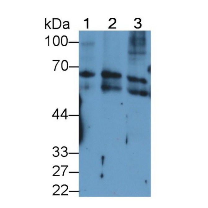 Keratin 2 (CK2) Human Monoclonal Antibody