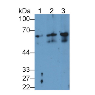 Keratin 2 (CK2) Human Monoclonal Antibody