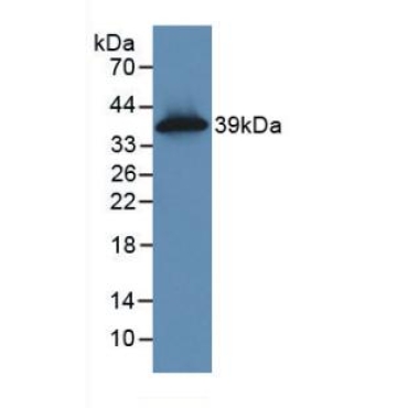 Cytokeratin 16 (CK16) Human Monoclonal Antibody