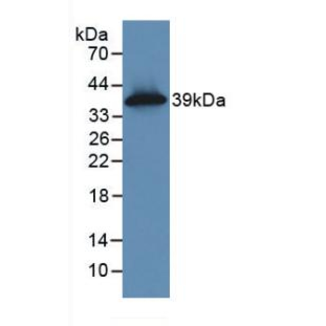 Cytokeratin 16 (CK16) Human Monoclonal Antibody