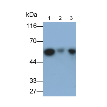 Cytokeratin 15 (CK15) Human Monoclonal Antibody