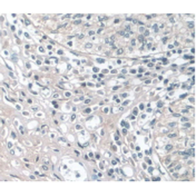Apolipoprotein A1 (APOA1) Human Monoclonal Antibody