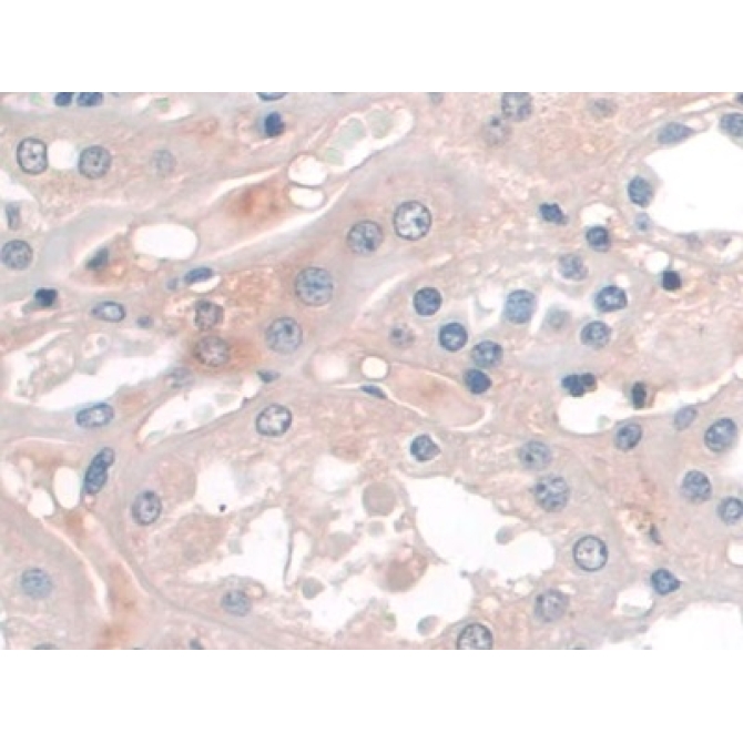 Apolipoprotein A1 (APOA1) Human Monoclonal Antibody