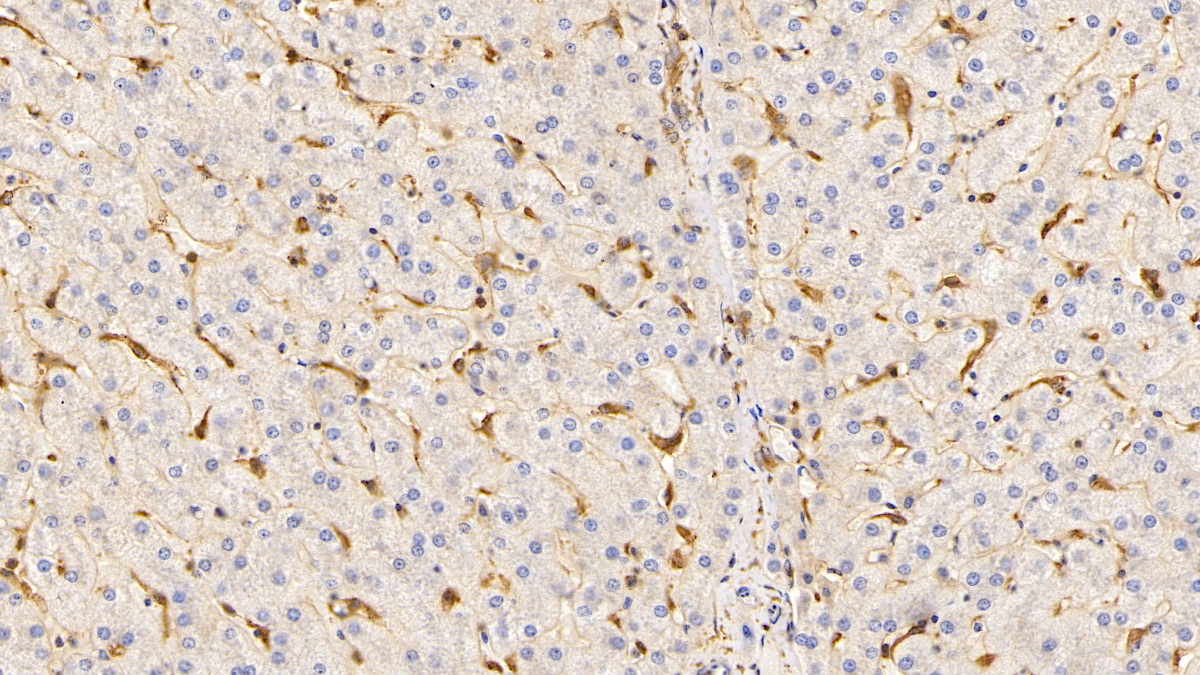 Apolipoprotein A1 (APOA1) Human Monoclonal Antibody
