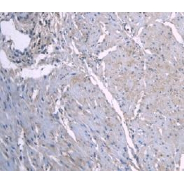 Apolipoprotein A1 (APOA1) Human Monoclonal Antibody