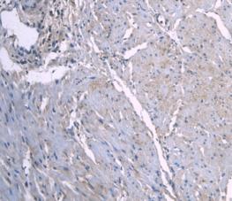Apolipoprotein A1 (APOA1) Human Monoclonal Antibody