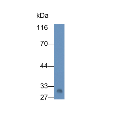 Apolipoprotein A1 (APOA1) Human Monoclonal Antibody