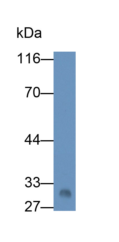 Apolipoprotein A1 (APOA1) Human Monoclonal Antibody