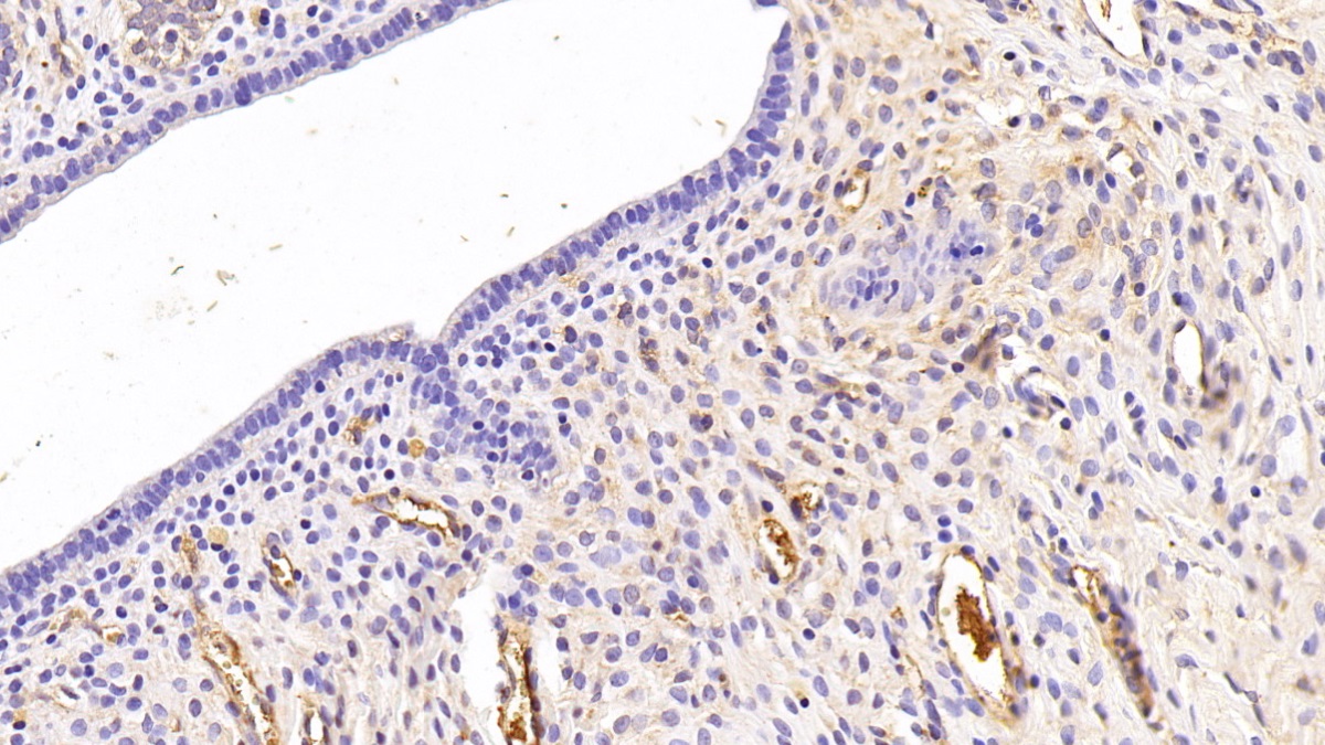 Apolipoprotein A1 (APOA1) Rat Monoclonal Antibody