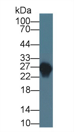 Apolipoprotein A1 (APOA1) Rabbit Monoclonal Antibody