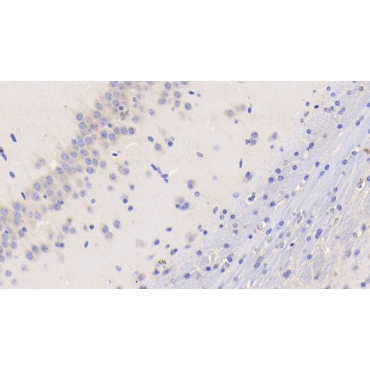 Tissue Factor (TF) Mouse Monoclonal Antibody