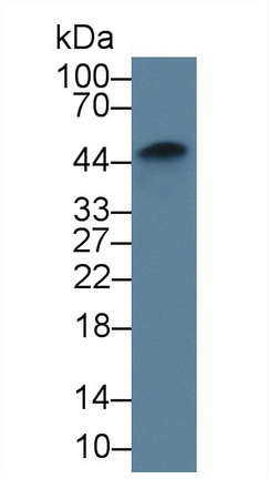 Tissue Factor (TF) Rabbit Monoclonal Antibody