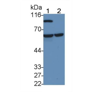 Tissue Plasminogen Activator (tPA) Human Monoclonal Antibody