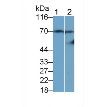 Tissue Plasminogen Activator (tPA) Human Monoclonal Antibody