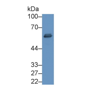 Tissue Plasminogen Activator (tPA) Human Monoclonal Antibody
