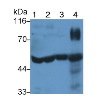 Tissue Plasminogen Activator (tPA) Human Monoclonal Antibody