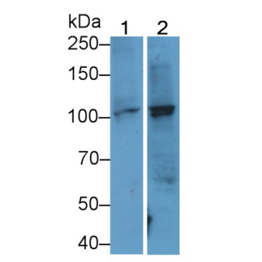 Thrombomodulin (TM) Human Monoclonal Antibody