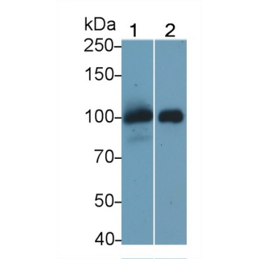 Thrombomodulin (TM) Human Monoclonal Antibody